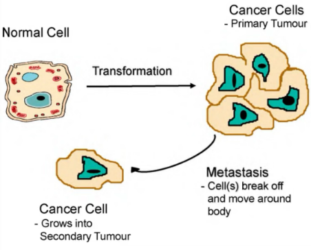 <p>"A normal cell transforms into a cancer cell by losing growth control, forming a primary tumor that can metastasize into secondary tumors." </p>