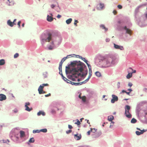 <p>Acanthamoeba spp</p>