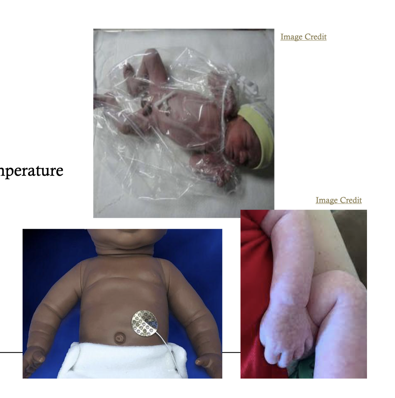 <ul><li><p>pre warmed radiant warmer or incubator</p></li><li><p>polyethylene bag</p></li><li><p>sticker probe used ot maintain stable body temperature</p></li></ul><p></p><ul><li><p><strong>hypothermia</strong></p><ul><li><p>symptoms</p><ul><li><p>acrocyanocis, cool skin, pale, hyporeactivity, low blood sugar, </p></li></ul></li><li><p>gradeal rewarming recommended</p></li></ul></li></ul><p></p>