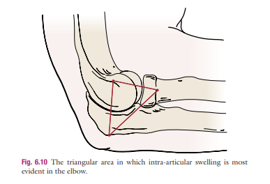 <p>Lateral elbow / epicondylar area</p>