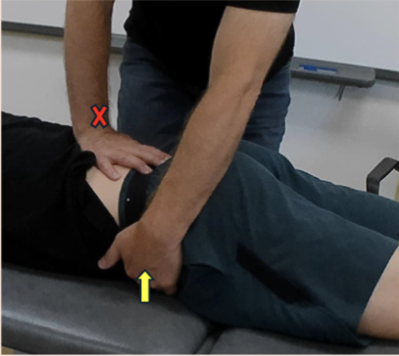 <p>- alternative to the sheer test to help identify SI hypomobility</p><p>- stabilize the lumbar spine by palpating fingers into sacral sulcus, with other hand, flick the ilium posteriorly to assess for hypomobility on each side</p>