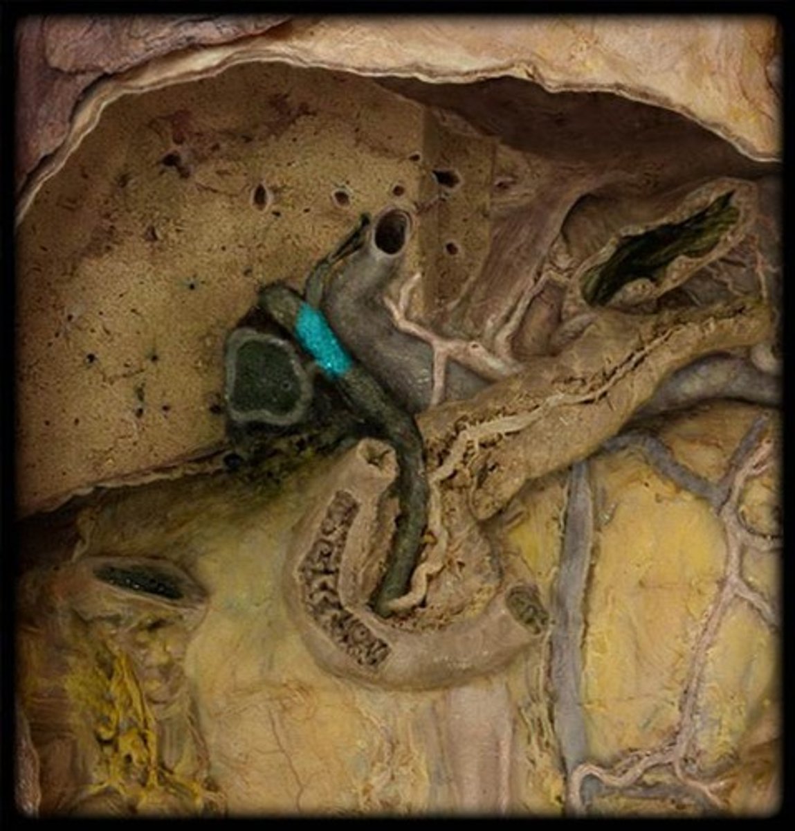 <p>Name this passageway.</p>