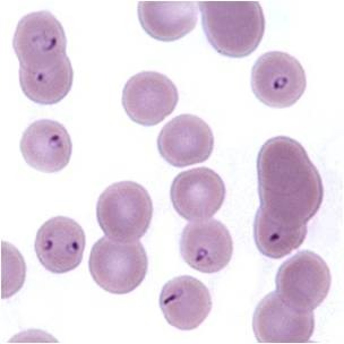<p>Feline piroplasm "bejeweled ring" within stained RBCs of cats</p>
