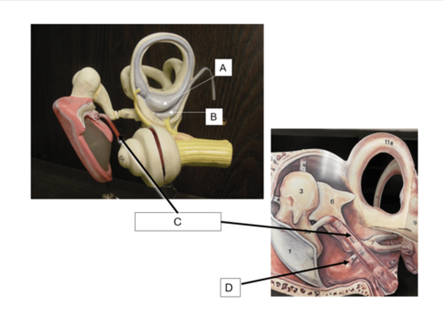 <p>What is the arrow of the letter B pointing to?</p>
