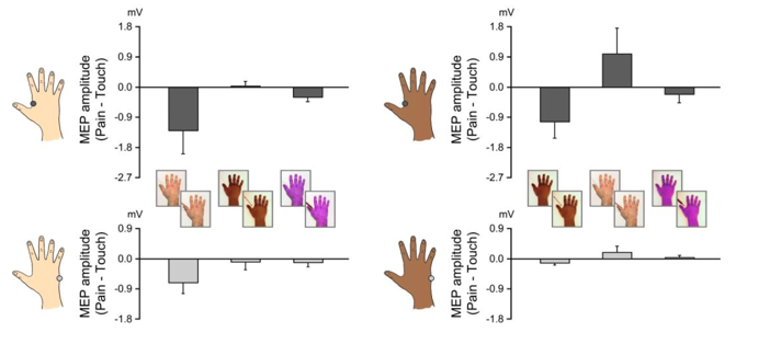 <p>Aventant et al (2010) violet skin effect</p>