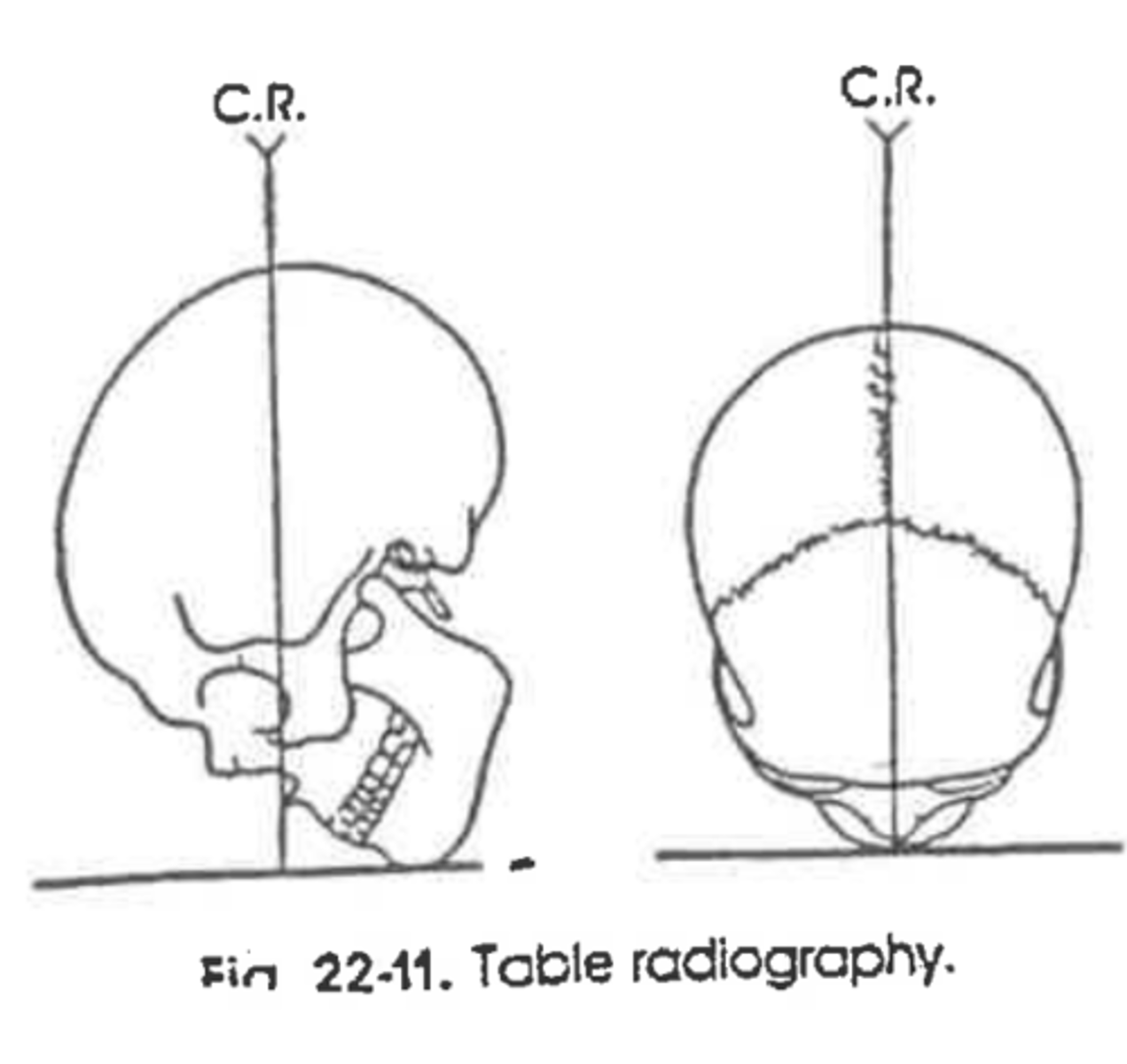<p>Method:</p><p>Projection:</p>