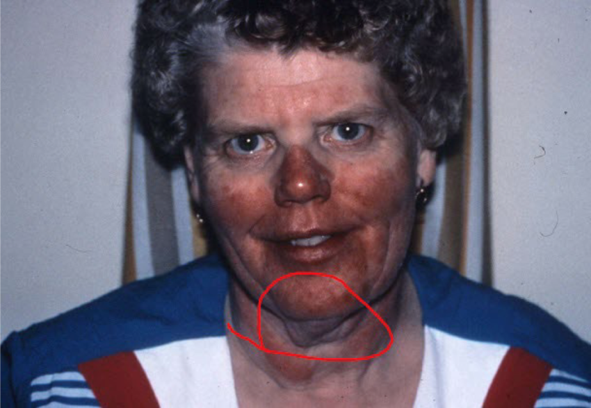 term image