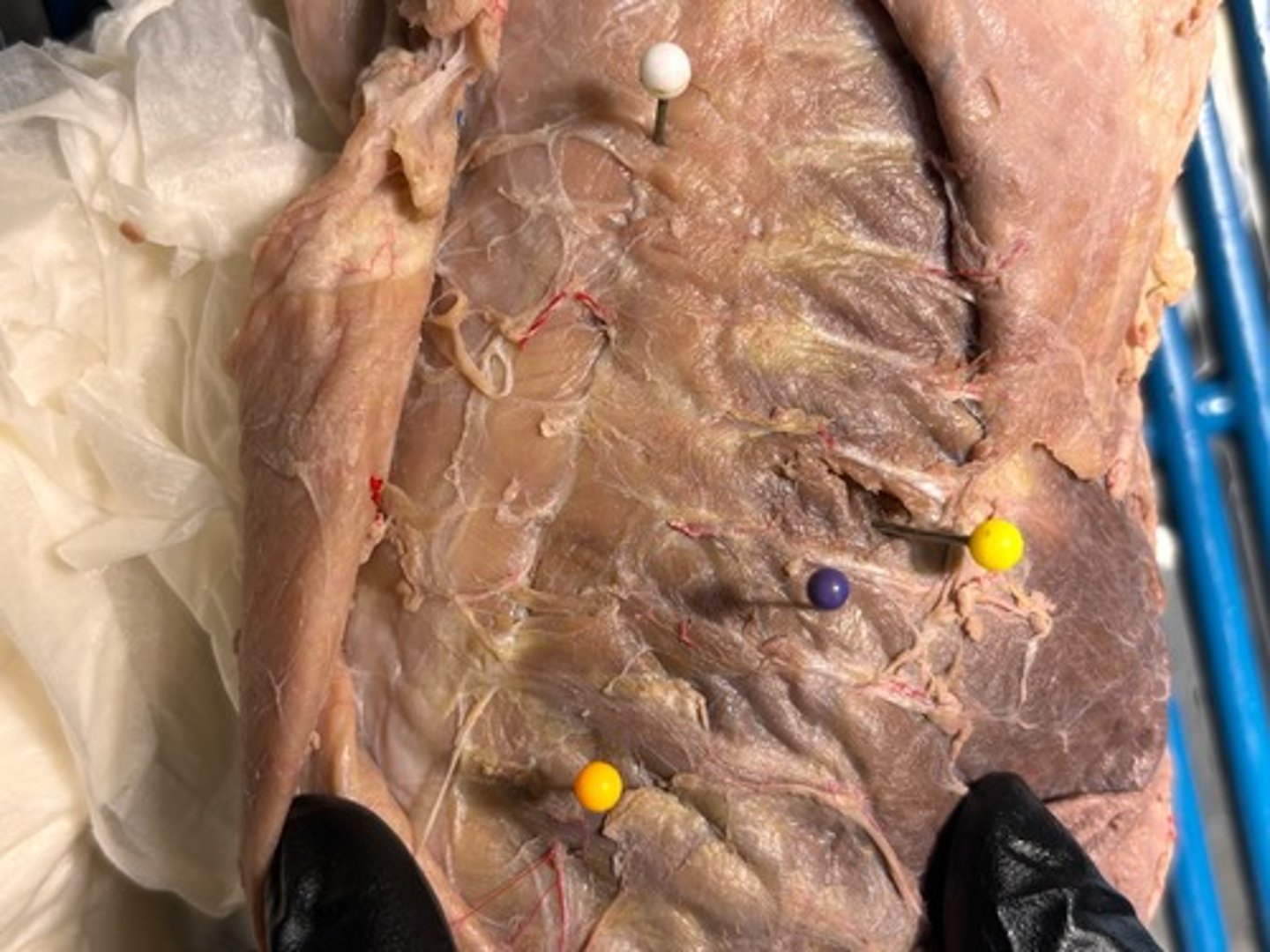 <p>What thoracic muscle is the yellow pin in</p>