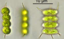 <p>Frw plankton SPINES</p>