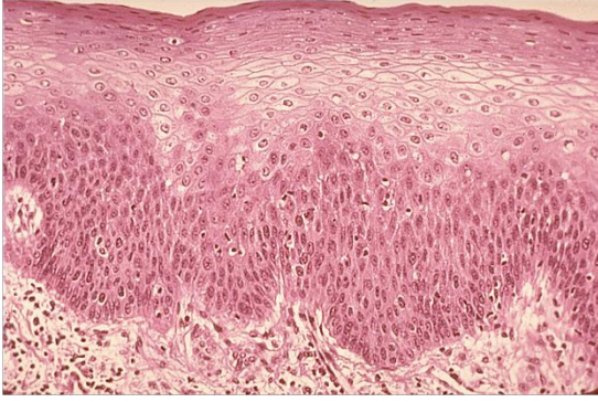 <p>stratified squamous epithelial tissue</p>