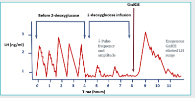 <p><span style="color: purple;">blood glucose and fatty acid</span> concentrations can <span style="color: purple;">modify GnRH pulse frequency </span>to alter reproductive status</p><p><span><strong>The Experiment</strong>: Researchers use </span><span style="color: purple;">ovariectomized ewe lambs</span><span> (ovaries removed) to isolate the brain. This lets them study exactly how the </span><span style="color: purple;">hypothalamus </span><span>reacts to nutrition without ovarian hormones getting in the way.</span></p><p><span><strong>Creating a Synthetic Energy Deficit</strong>: Giving them</span><span style="color: purple;"> 2-deoxyglucose (2DG) </span><span>stops the body from metabolizing glucose. This tricks the body into pretending it has zero sugar reserves, simulating an acute </span><span style="color: purple;">starvation situation.</span></p><p><span><strong>Hypothalamus Response</strong>: The hypothalamus detects this low blood sugar phenomenon and drastically</span><span style="color: purple;"> decreases both the frequency and amplitude</span><span> of GnRH pulses.</span></p><p><span><strong>The Downstream Effect</strong>: Because the brain's baseline pulses flatten out, the pituitary cannot release the massive</span><span style="color: purple;"> preovulatory LH surge</span><span> required to trigger ovulation.</span></p><p><span><strong>Real-World Link</strong>: This explains why </span><span style="color: purple;">anorexic individuals</span><span> or animals in a severe energy deficit stop cycling entirely—the brain actively puts the brakes on GnRH and LH to prevent reproduction during starvation.</span></p><p></p><p><span style="color: purple;">flushing </span>- feeding ewes higher plane of nutrition - more follicles recruited - so when ovulated more oocytes/follicles - twin/trippling pregnancy</p>
