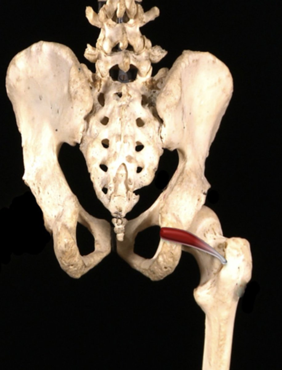 <p>ID muscle- laterally rotates hip</p>