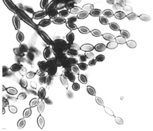 <p>Illustrated in this image is the fruiting head of one of the fungal agents of chromomycosis. Which of the following represents the type of sporulation illustrated here?</p>