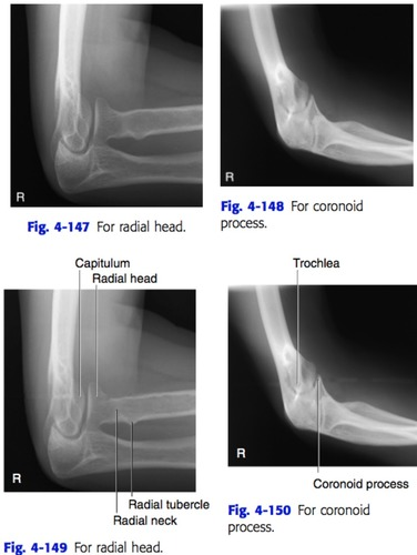 <p>toward</p><p></p><p>away</p>