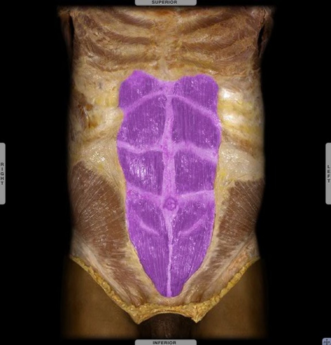 <p>This muscle flexes and rotates the spine</p>