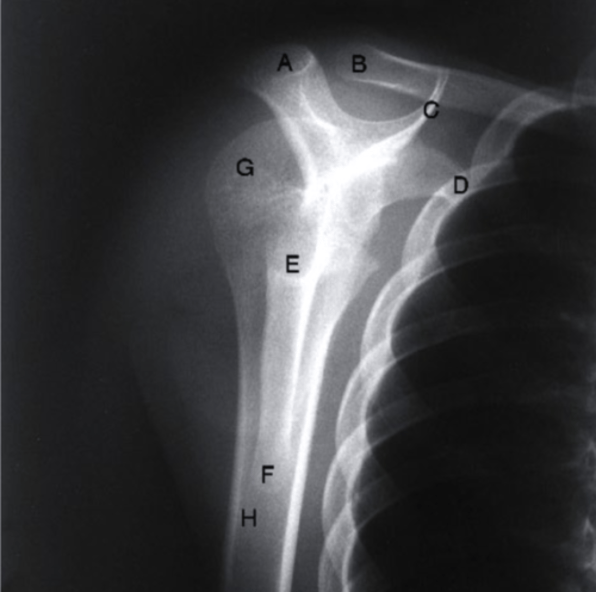 <p>what view is this</p>