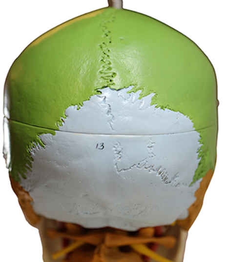 <p>Name the sagital suture</p>