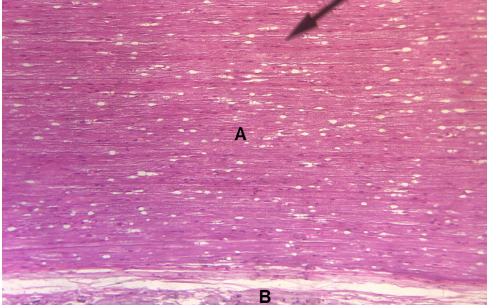 <p><span><span>In the image above, identify structures A and B.</span></span></p>