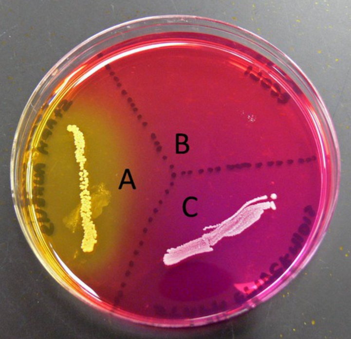 This plate medium helps to identify S. aureus because the species often ferments this carbohydrate (yellow). Phenol red is used as a ph indicator. Sodium chloride helps to inhibit other microbes. S. epi is pink
