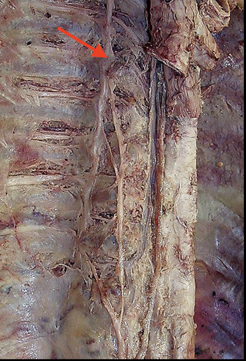 <p>Structure?</p>
