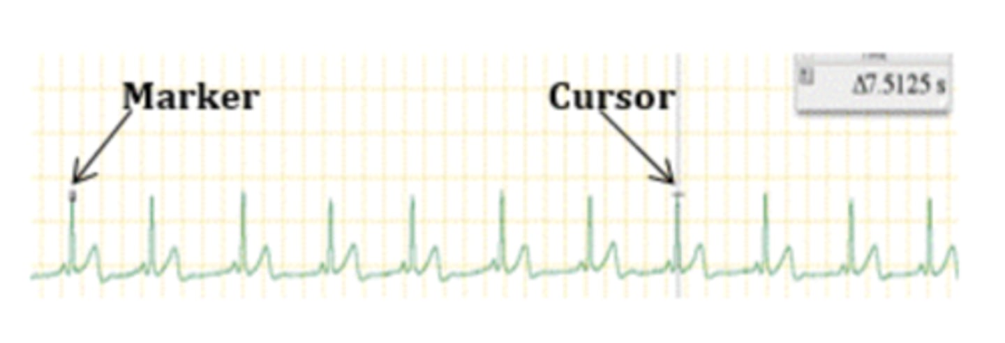 <p>(7 beats / 7.5125 seconds)*(60 seconds / minute) = 55.9 bpm</p><p>3 multiple choice options</p>