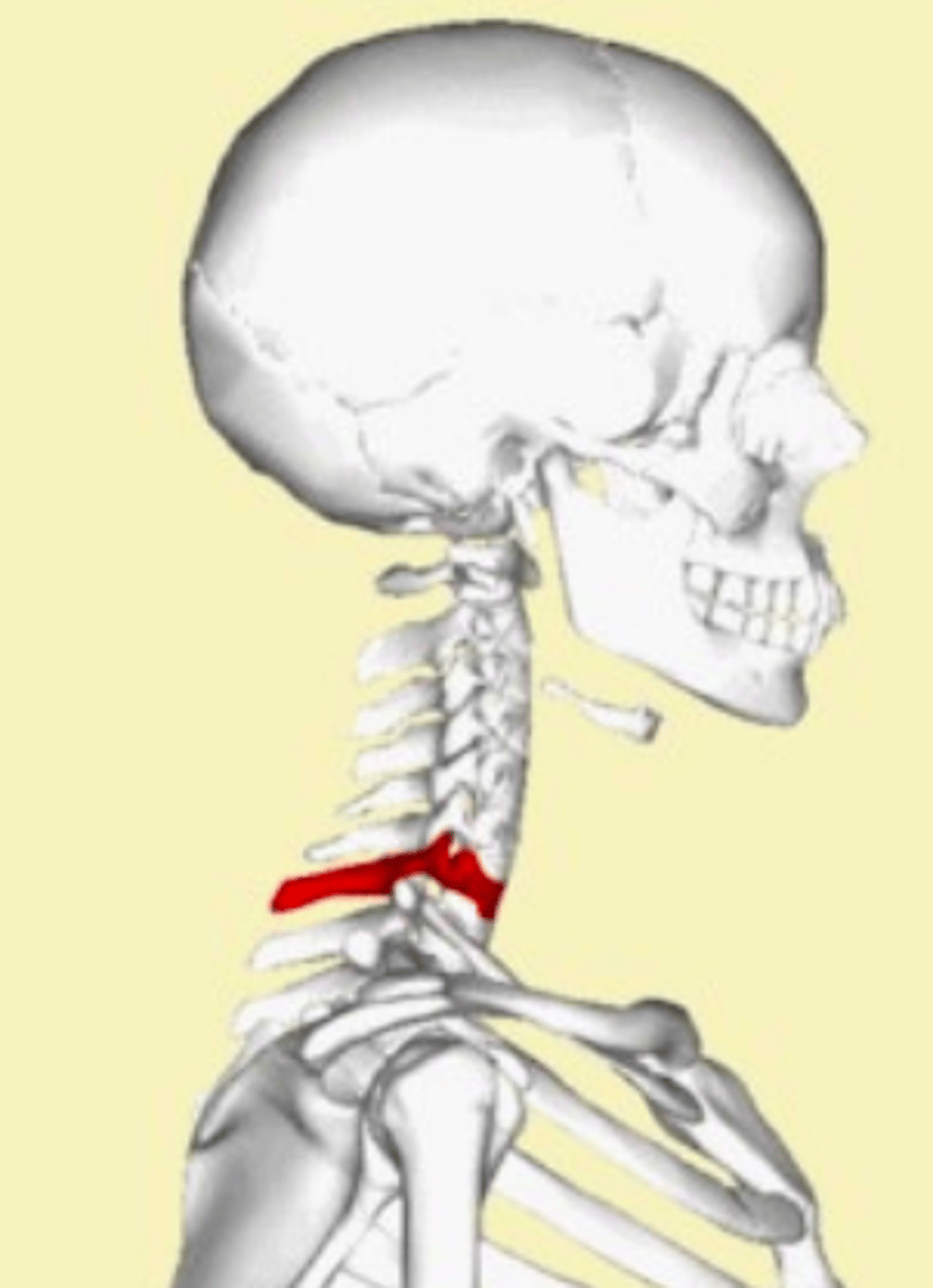 <p>No bifid spinous process</p><p>Spinous process called the VERTEBRAL PROMINENCE</p>