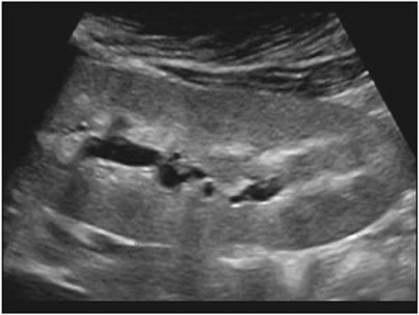 <p>enlarged; functioning</p>