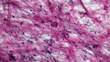 <p>Loose connective areolar, adipose, or reticular?</p>