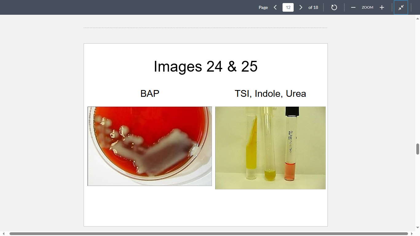 <p>A 40-year-old male is admitted to University Hospital with high fever, general malaise and respiratory distress. Laboratory testing reveals the patient has damage to both his kidneys and liver. A sputum sample reminiscent of “currant jelly” yields the following isolate (Images 24&25). Chest X-ray confirms the patient has a bilateral pneumonia. What is the most likely cause?</p>