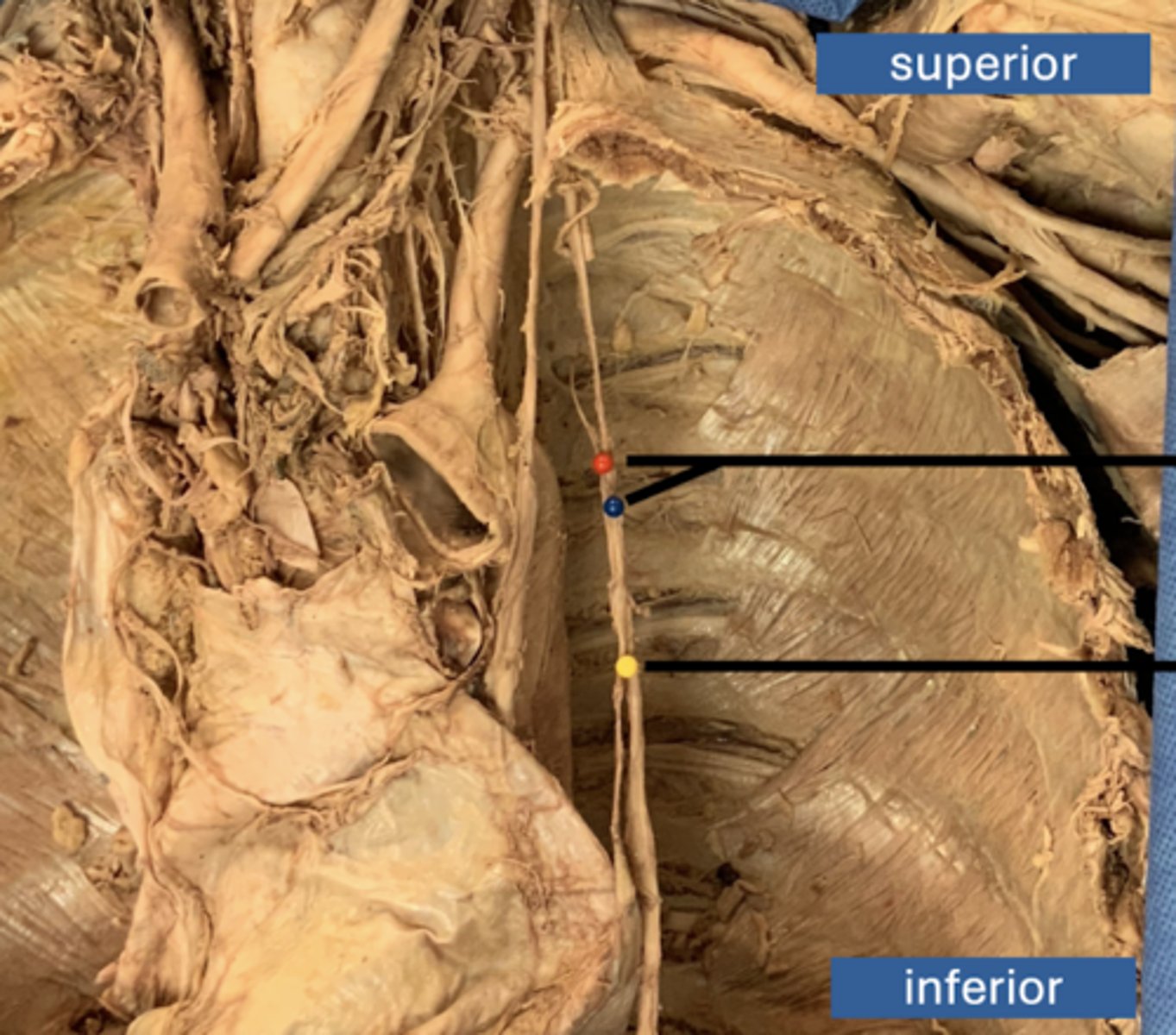 <p>artery</p>