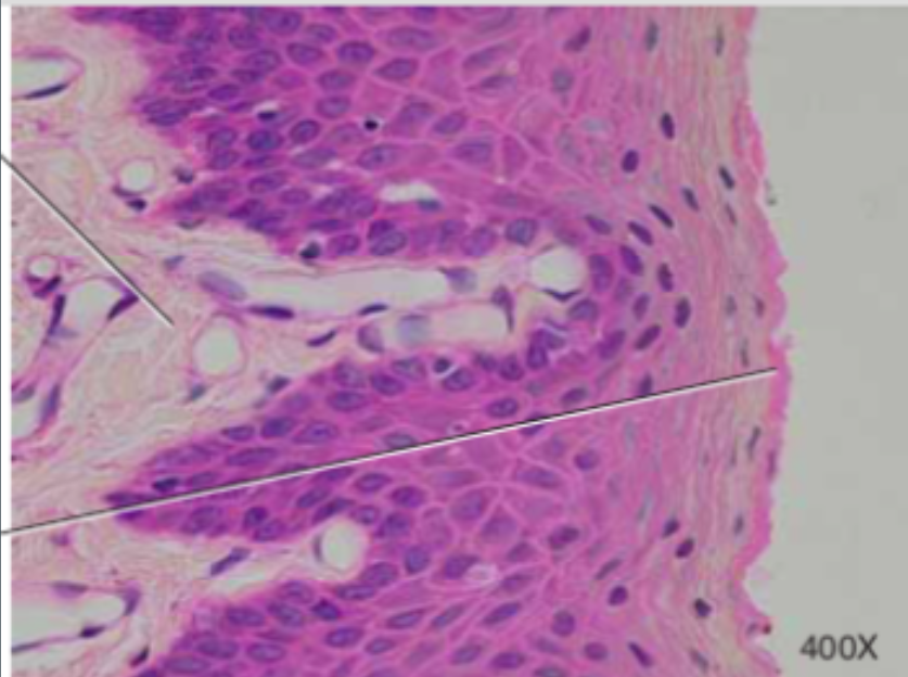 <p>(epithellial) looks like several layers of flat, scale-like, fish eggs</p>