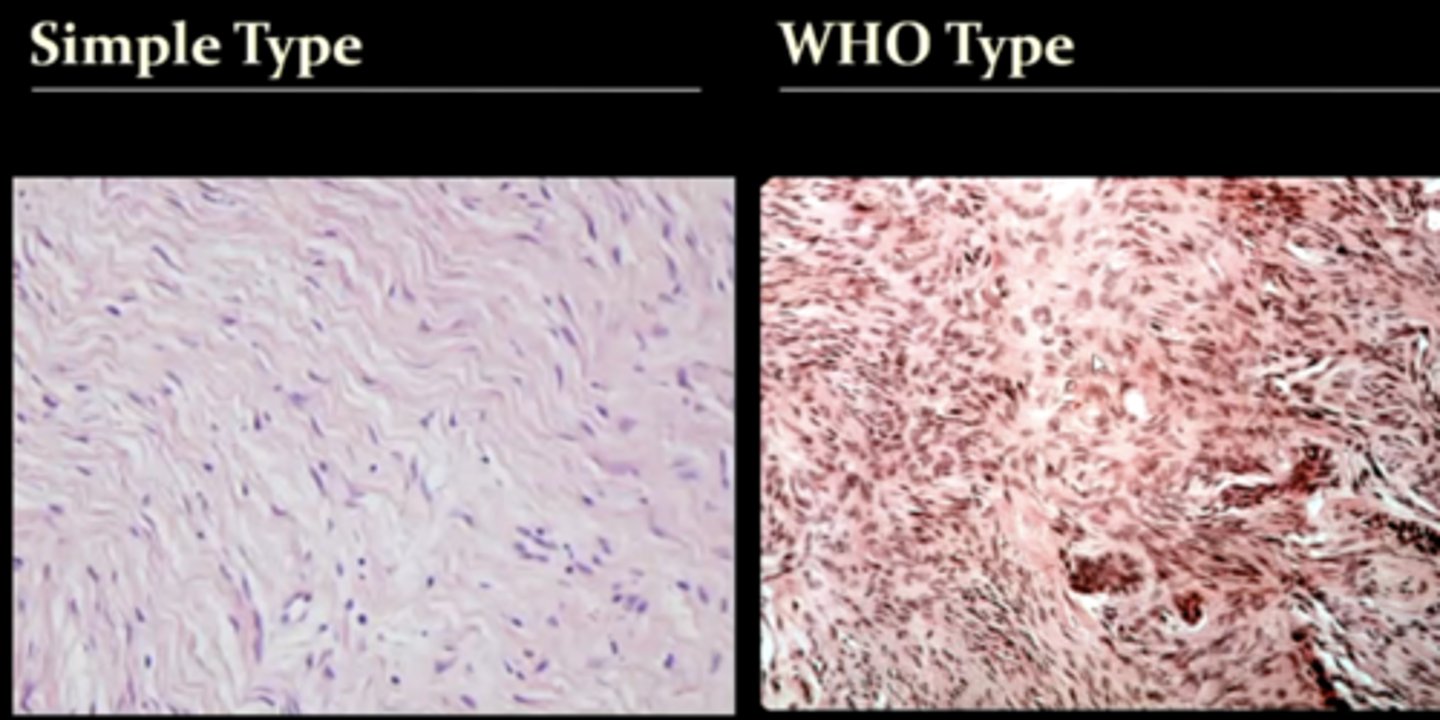 <p>1. simple type</p><p>2. WHO type</p><p>know that the WHO type has more calcifications in it</p>