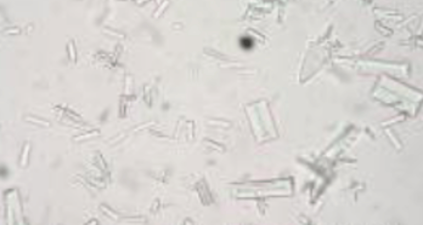 <p>- Also called triple phosphates</p><p>- Shaped like a coffin lid (6-8 sided prism) with tapered edges</p><p>- Most common</p>