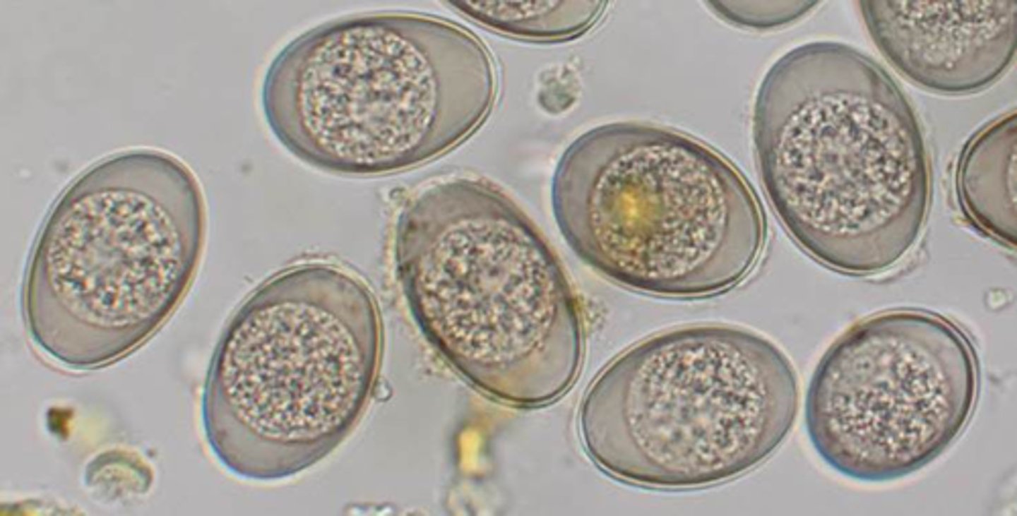 <p>These structures were found on the fecal flotation of a 15 week old calf. What are they?</p>