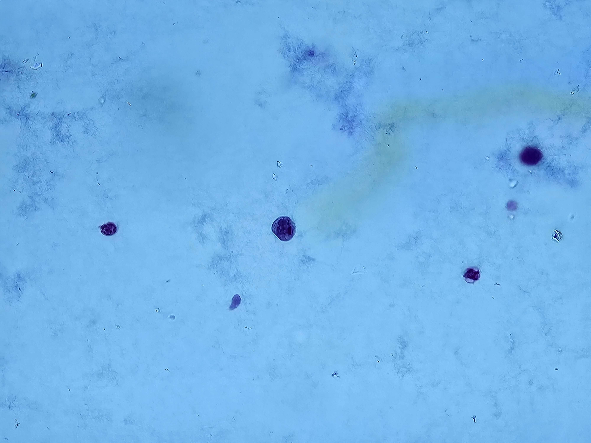 <p><span data-name="microscope" data-type="emoji">🔬</span><span data-name="petri_dish" data-type="emoji">🧫</span><strong><span> </span>Na podstawie zdjęcia preparatu:</strong></p><p></p><ul><li><p><span data-name="book" data-type="emoji">📖</span><span> </span>rozpoznaj gatunek pasożyta;</p></li></ul><p></p><ul><li><p><span data-name="recycle" data-type="emoji">♻</span><span> </span>rozpoznaj wszystkie formy rozwojowe;</p></li></ul><p></p><ul><li><p><span data-name="microbe" data-type="emoji">🦠</span><span> </span>wskaż organelle i cechy charakterystyczne dla danego gatunku;</p></li></ul><p></p><ul><li><p><span data-name="mask" data-type="emoji">😷</span><span> </span>nazwij chorobę, którą pasożyt wywołuje.</p></li></ul><p></p>