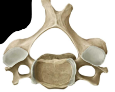 <p>Name type of bone </p>