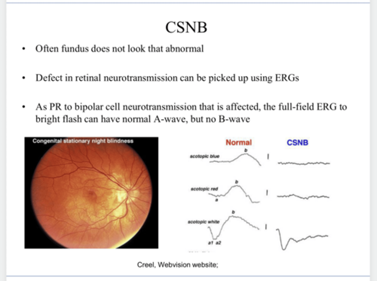 <p>Does the fundus look very abnormal in a patient with Congenital Stationary Night Blindness?</p>