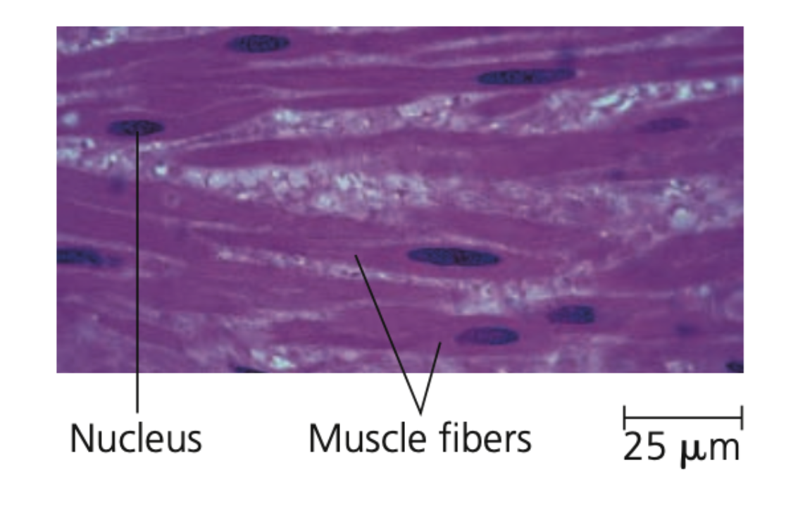 Smooth muscle
➔ Lacks striations, found in the walls of the digestive tract, urinary _____, arteries, and other internal organs 
➔ Cells are ______-shaped
➔ _______ body activities, such as churning of stomach and construction of arteries
