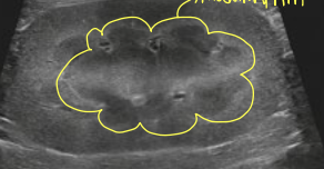 <p>what is the yellow indicating?</p>