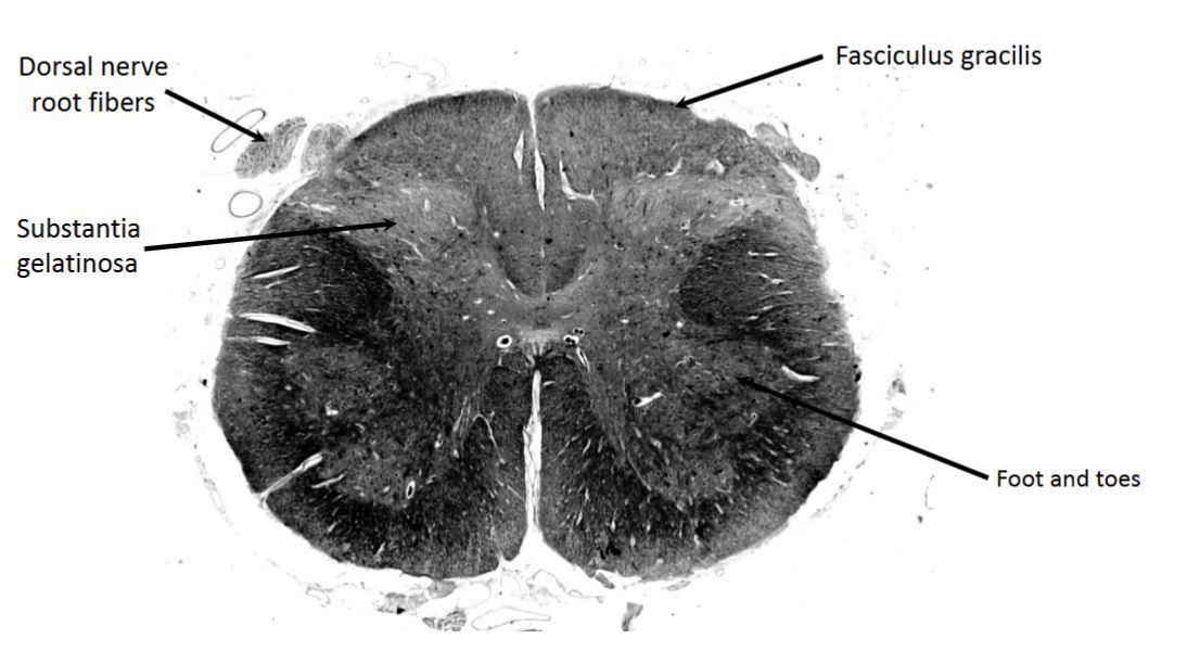 <p>lumbosacral enlargement</p>