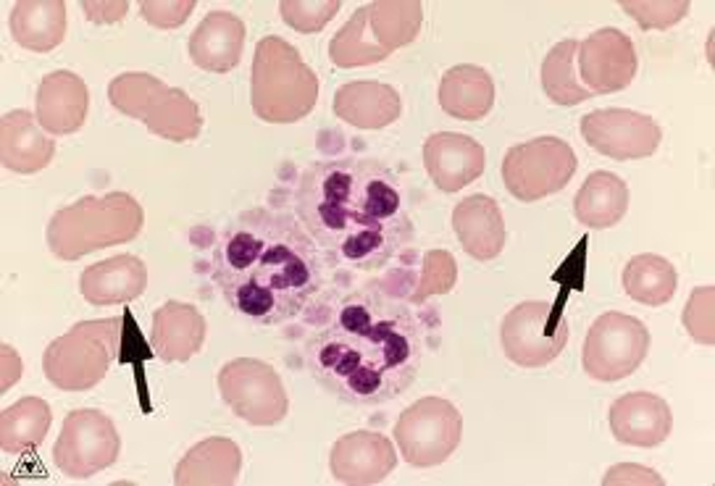 <p>decreased red blood cell size</p>
