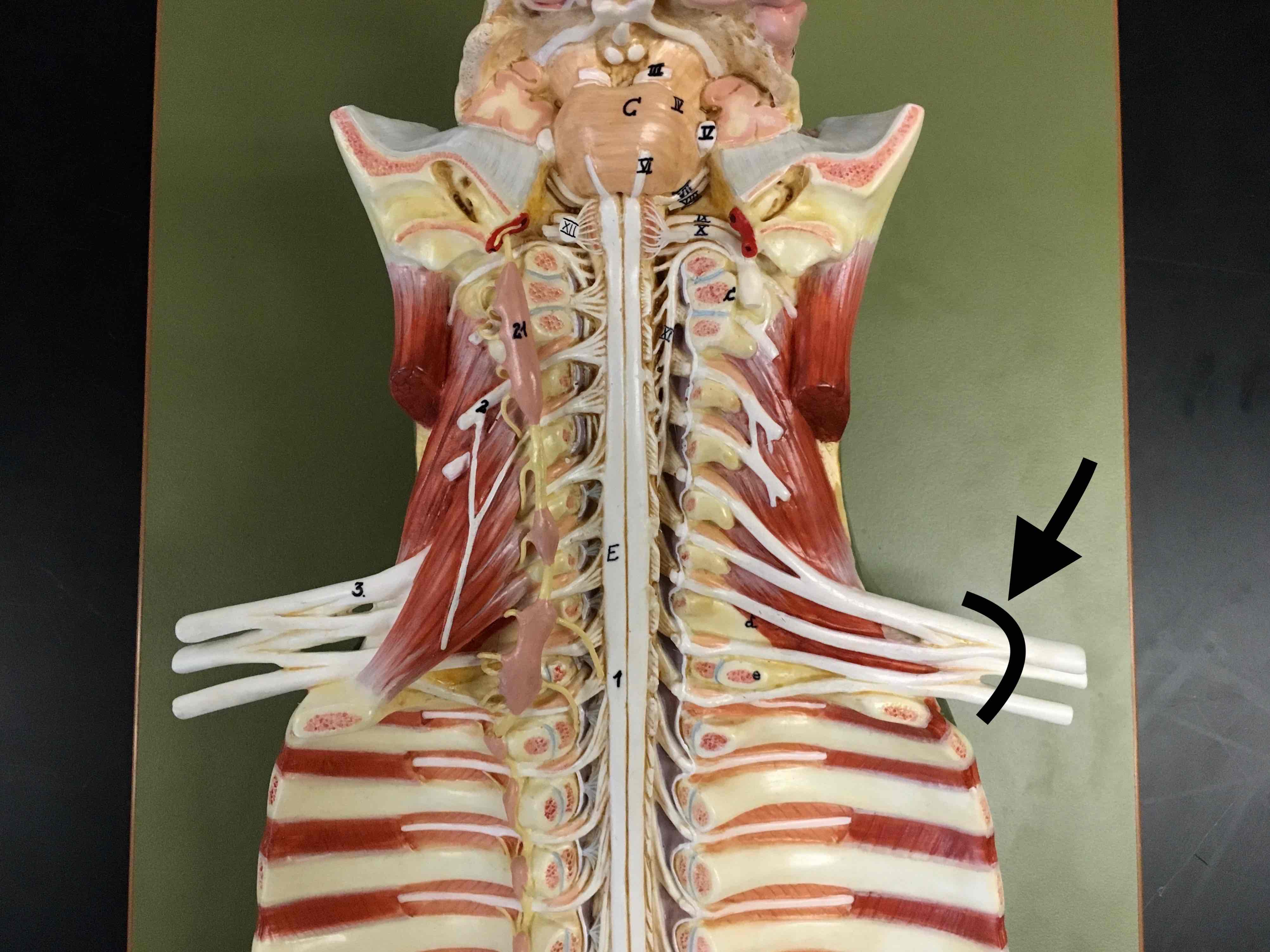 <p>name the specific cluster of white structures</p>