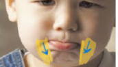 <p>L = below mouth, on the sides of chin</p><p>A = <strong>antagonist</strong> to zygomaticus, draws lips laterally, :(</p>