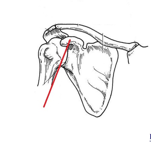 <p>korppilisäke</p>