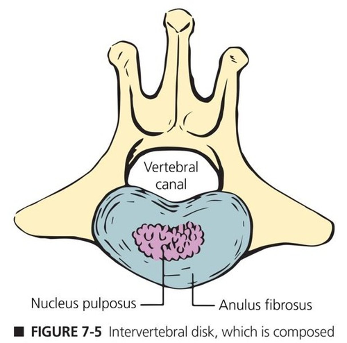 <p>Cushion of cartilage between vertebrae.</p>