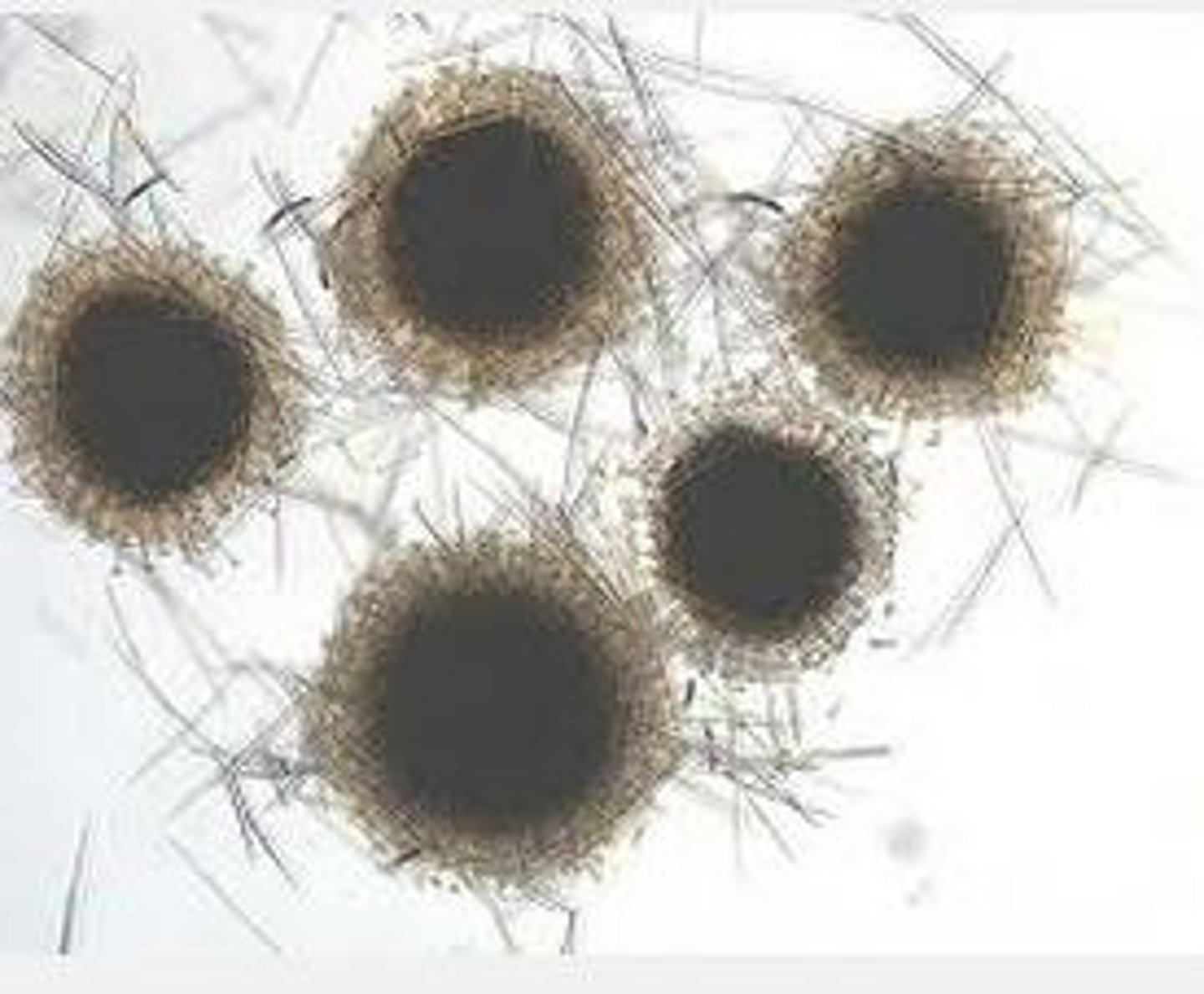 <p>Specialized, asexual, internal reproductive buds produced by freshwater sponges / Porifera to survive harsh conditions like freezing or drought</p><p>Allow sponges to survive in a dormant state and later develop into new adults when environmental conditions improve.</p>