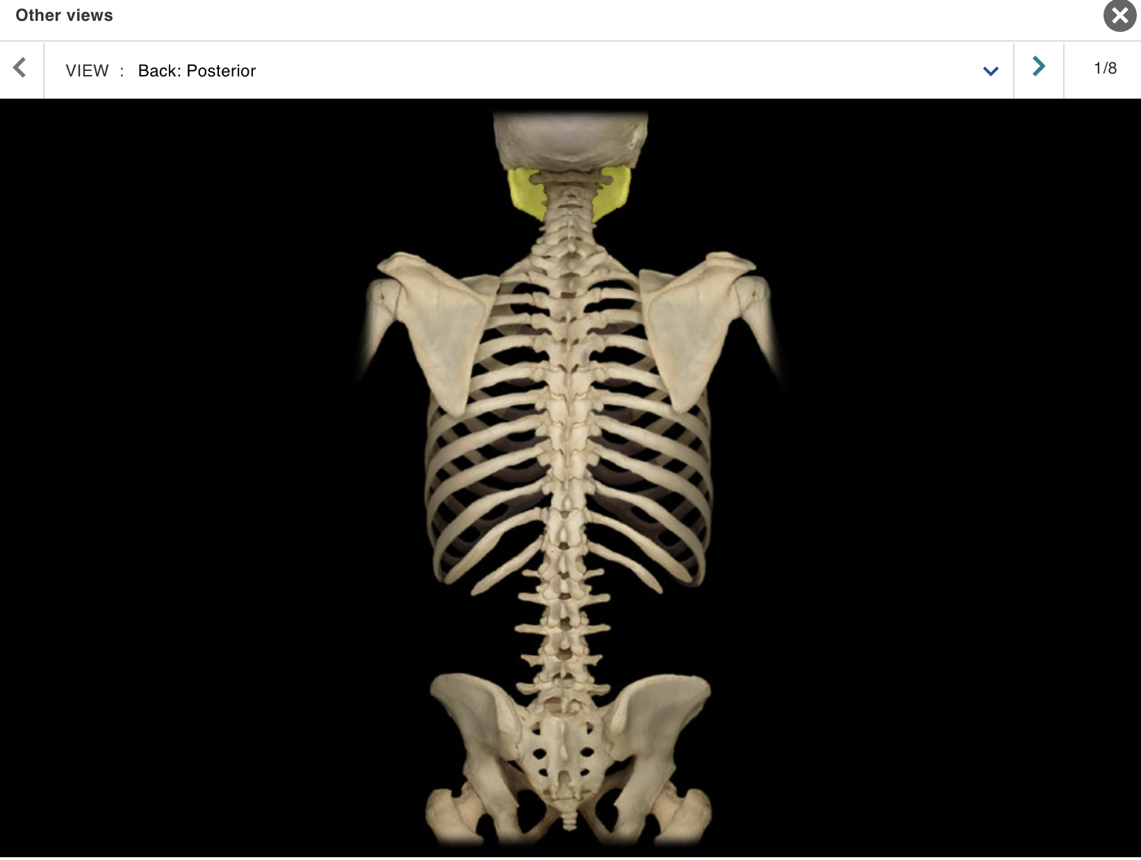 <p>Location:</p><p class="p1">• Skull (anterior)</p><p class="p1">Description:</p><ul><li><p>﻿﻿U-shaped bone</p></li><li><p>﻿﻿Each side consists of body (horizontal) and ramus (vertical) with coronoid and condylar processes</p></li><li><p>﻿﻿Mental protuberance forms point of chin</p></li><li><p>﻿﻿Contains alveoli ("sockets") for teeth</p></li></ul><p>Also known as:</p><p class="p1">• "Lower jaw"</p><p class="p1">Comment:</p><p class="p1">• Contributes to temporomandibular joint (TMJ)</p>