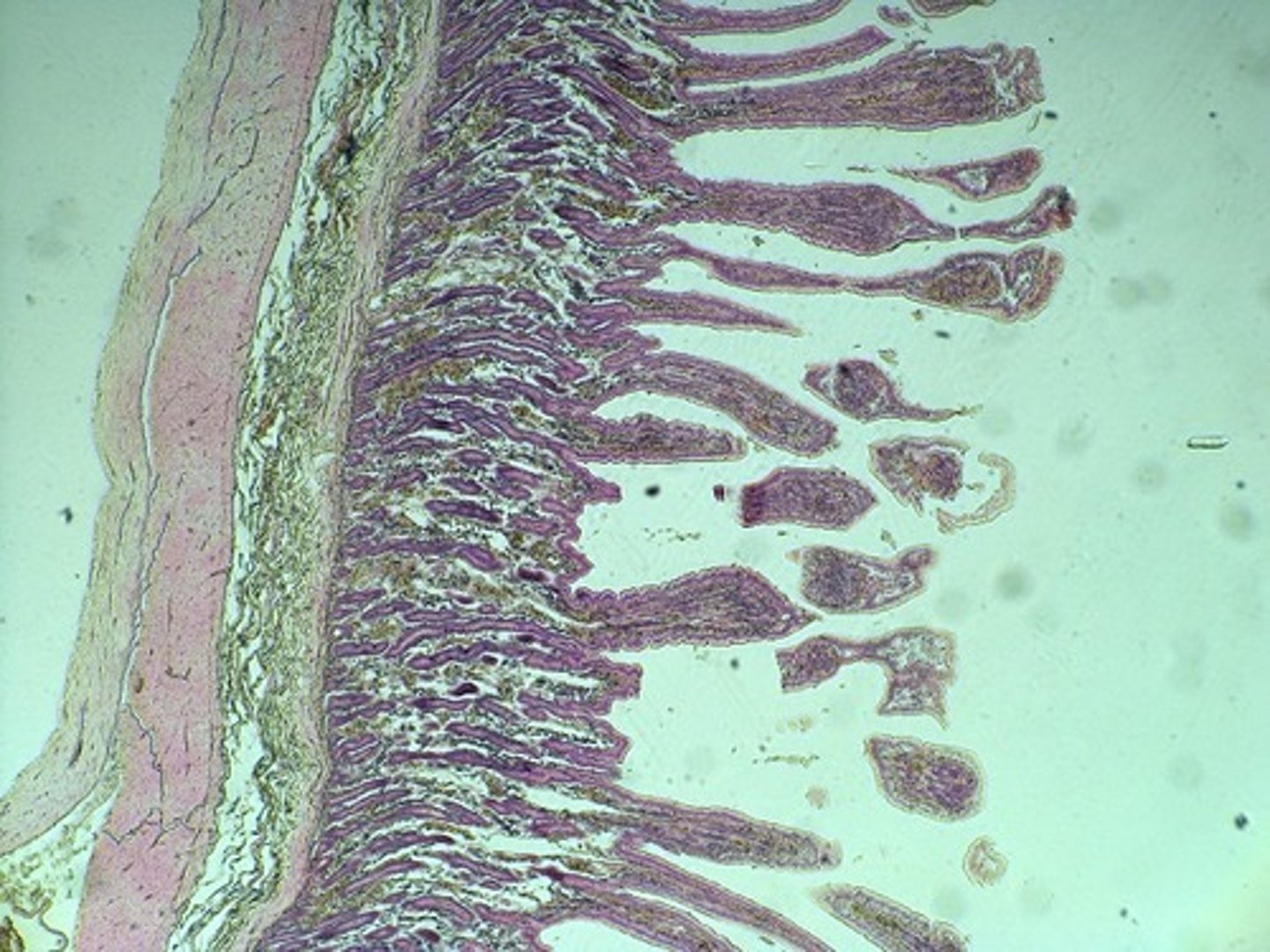 <p>This is a slide of what region of the GI tract?</p>
