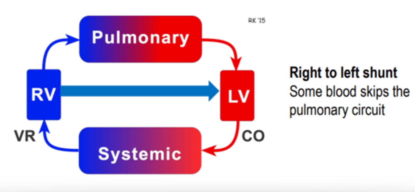 <p>The blood never goes through the lungs, therefore can never be oxygenated so giving more oxygen is pointless</p>