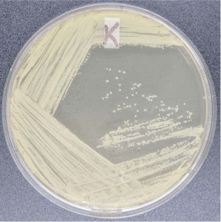 <p>Selective only</p><p>— selective for G+, G- cannot grow </p><p>— phenylethyl alcohol inhibits the DNA synthesis of G-, making         them unable to grow</p><p>useful for isolating, growing, and maintaining G+ organisms</p>
